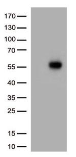 IL3RA Antibody in Western Blot (WB)