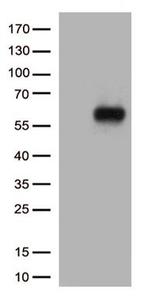 IL3RA Antibody in Western Blot (WB)
