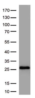 SARS-CoV-2 Spike Protein Antibody in Western Blot (WB)