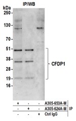 CFDP1 Polyclonal Antibody