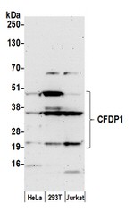 CFDP1 Polyclonal Antibody