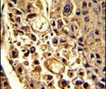 CFHR1 Antibody in Immunohistochemistry (IHC)