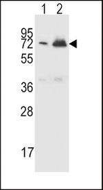CFHR5 Antibody in Western Blot (WB)