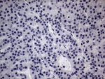 CFI Antibody in Immunohistochemistry (Paraffin) (IHC (P))