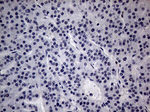 CFI Antibody in Immunohistochemistry (Paraffin) (IHC (P))