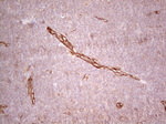 CFI Antibody in Immunohistochemistry (Paraffin) (IHC (P))