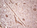 CFI Antibody in Immunohistochemistry (Paraffin) (IHC (P))