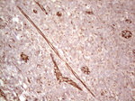 CFI Antibody in Immunohistochemistry (Paraffin) (IHC (P))