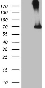 CFI Antibody in Western Blot (WB)