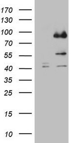 CFI Antibody in Western Blot (WB)