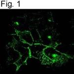 CFTR Polyclonal Antibody
