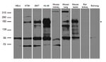 CFTR Antibody in Western Blot (WB)