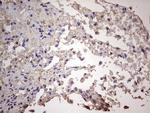 CGB Antibody in Immunohistochemistry (Paraffin) (IHC (P))