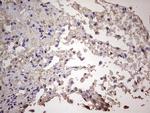 CGB Antibody in Immunohistochemistry (Paraffin) (IHC (P))