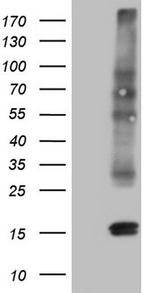 CGB Antibody in Western Blot (WB)
