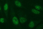 CHAF1B Antibody in Immunocytochemistry (ICC/IF)