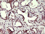 CHAF1B Antibody in Immunohistochemistry (Paraffin) (IHC (P))