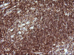 CHAF1B Antibody in Immunohistochemistry (Paraffin) (IHC (P))