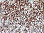 CHAF1B Antibody in Immunohistochemistry (Paraffin) (IHC (P))