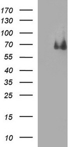 CHAF1B Antibody in Western Blot (WB)