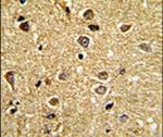 RCBTB2 Antibody in Immunohistochemistry (IHC)