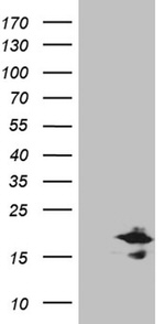 CHCHD10 Antibody in Western Blot (WB)