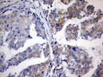 CHCHD3 Antibody in Immunohistochemistry (Paraffin) (IHC (P))