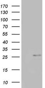 CHCHD3 Antibody in Western Blot (WB)