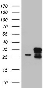 CHCHD3 Antibody in Western Blot (WB)