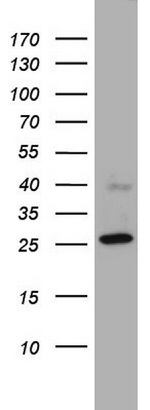 CHCHD3 Antibody in Western Blot (WB)
