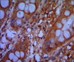 CHD3 Antibody in Immunohistochemistry (Paraffin) (IHC (P))