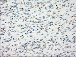 CHEK2 Antibody in Immunohistochemistry (Paraffin) (IHC (P))