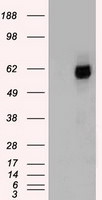 CHEK2 Antibody in Western Blot (WB)