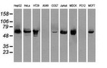 CHEK2 Antibody in Western Blot (WB)