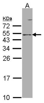 FOXN3 Antibody in Western Blot (WB)