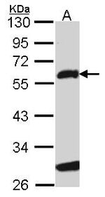 FOXN3 Antibody in Western Blot (WB)
