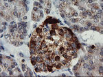 CHGA Antibody in Immunohistochemistry (Paraffin) (IHC (P))