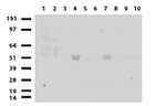 CHGA Antibody in Western Blot (WB)