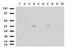 CHGA Antibody in Western Blot (WB)