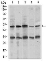Chromogranin A Monoclonal Antibody (1A6B6)