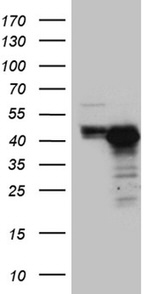 CHIA Antibody in Western Blot (WB)