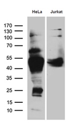 CHIA Antibody in Western Blot (WB)