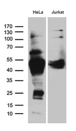CHIA Antibody in Western Blot (WB)