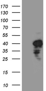 CHIA Antibody in Western Blot (WB)