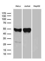 CHIA Antibody in Western Blot (WB)