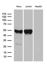 CHIA Antibody in Western Blot (WB)