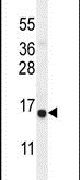 CHIC2 Antibody in Western Blot (WB)