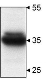 STUB1 Polyclonal Antibody