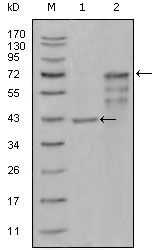 Chitotriosidase Monoclonal Antibody (1D9G2,1D9G4,2B4G3)