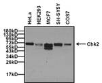 CHK2 Monoclonal Antibody (1C12B8)
